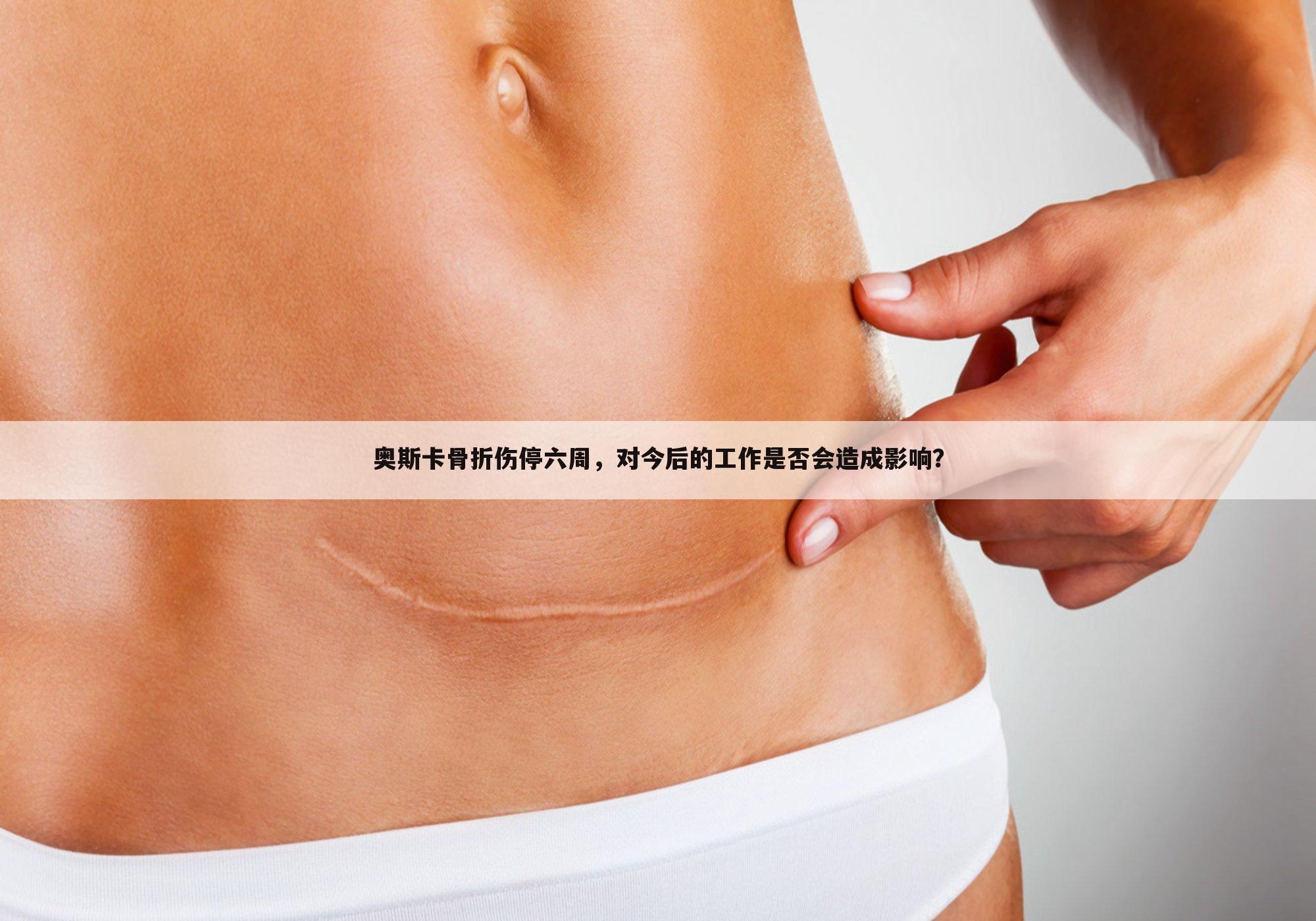 奥斯卡骨折伤停六周,对今后的工作是否会造成影响?