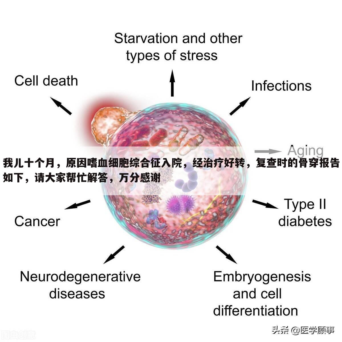 我儿十个月,原因嗜血细胞综合征入院,经治疗好转,复查时的骨穿报告如下,请大家帮忙解答,万分感谢