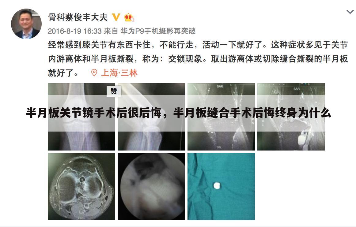 半月板关节镜手术后很后悔,半月板缝合手术后悔终身为什么