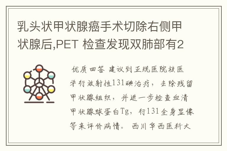 乳头状甲状腺癌手术切除右侧甲状腺后,PET 检查发现双肺部有2-3MM多发小结节是什么原因?是不是癌转移的情