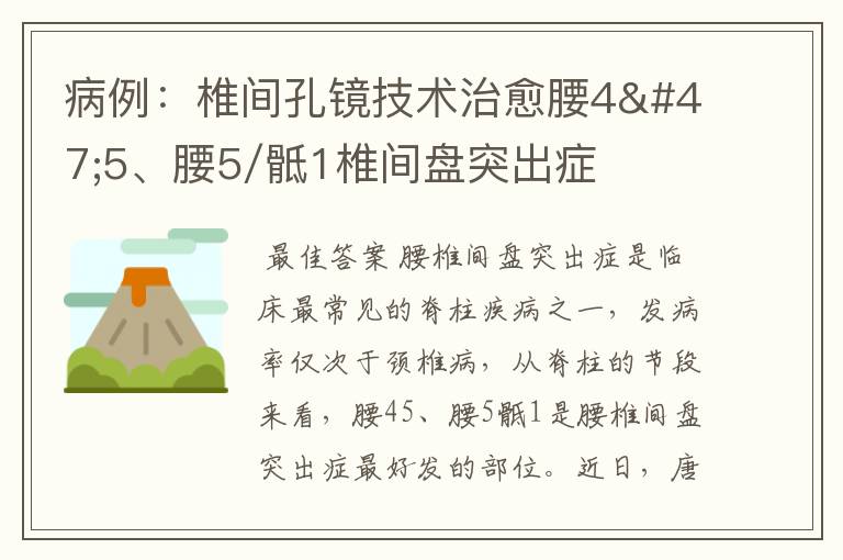 病例:椎间孔镜技术治愈腰4/5、腰5/骶1椎间盘突出症