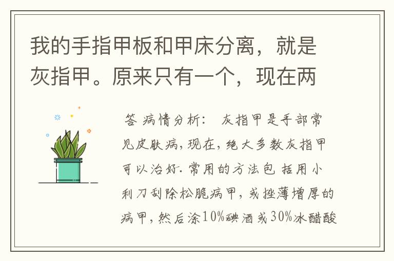 我的手指甲板和甲床分离,就是灰指甲。原来只有一个,现在两个手指都这样了,已经一年了。