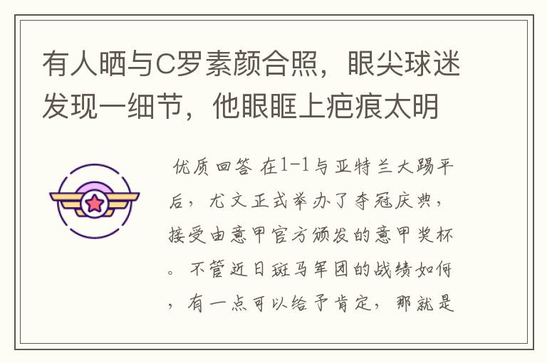 有人晒与C罗素颜合照,眼尖球迷发现一细节,他眼眶上疤痕太明显