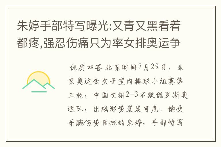 朱婷手部特写曝光:又青又黑看着都疼,强忍伤痛只为率女排奥运争冠
