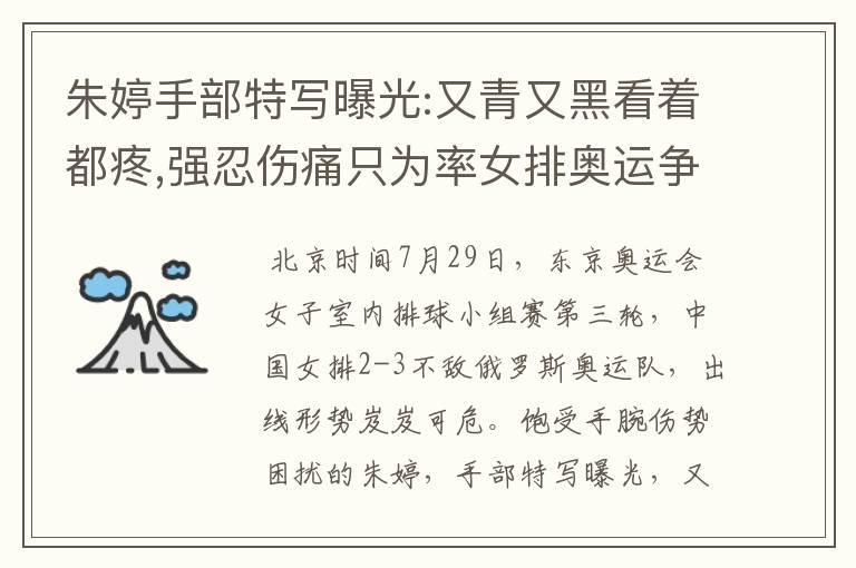 朱婷手部特写曝光:又青又黑看着都疼,强忍伤痛只为率女排奥运争冠
