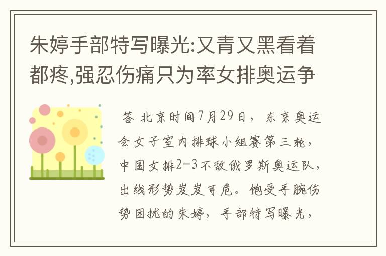 朱婷手部特写曝光:又青又黑看着都疼,强忍伤痛只为率女排奥运争冠